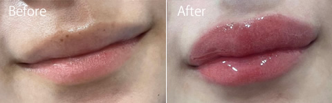 リップアートビフォーアフター