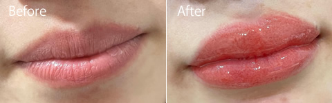 リップアートビフォーアフター