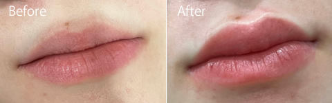 リップアートビフォーアフター