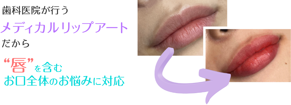 歯科医院が行うメディカルリップアートだから”唇”を含むお口全体のお悩みに対応